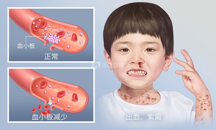 迷失方向 第62页