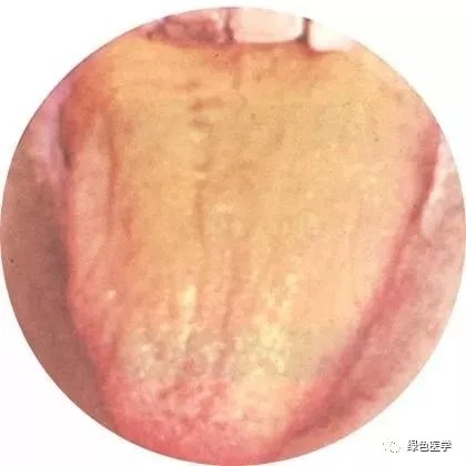 宝宝舌苔厚白是怎么回事？深度解析及应对策略