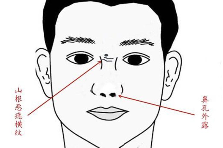 鼻梁上有横纹是怎么回事？深度解析鼻梁横纹的成因、影响及应对方法