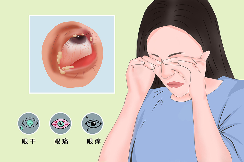 眼睛流泪是怎么回事？深度解析泪液分泌的奥秘与常见眼部问题