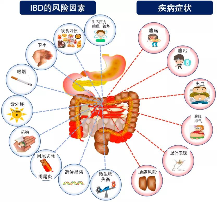 放屁多又臭是怎么回事？详解肠道健康与屁的奥秘