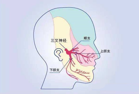 耳朵后面神经痛一阵一阵怎么办？探究病因及有效缓解方法