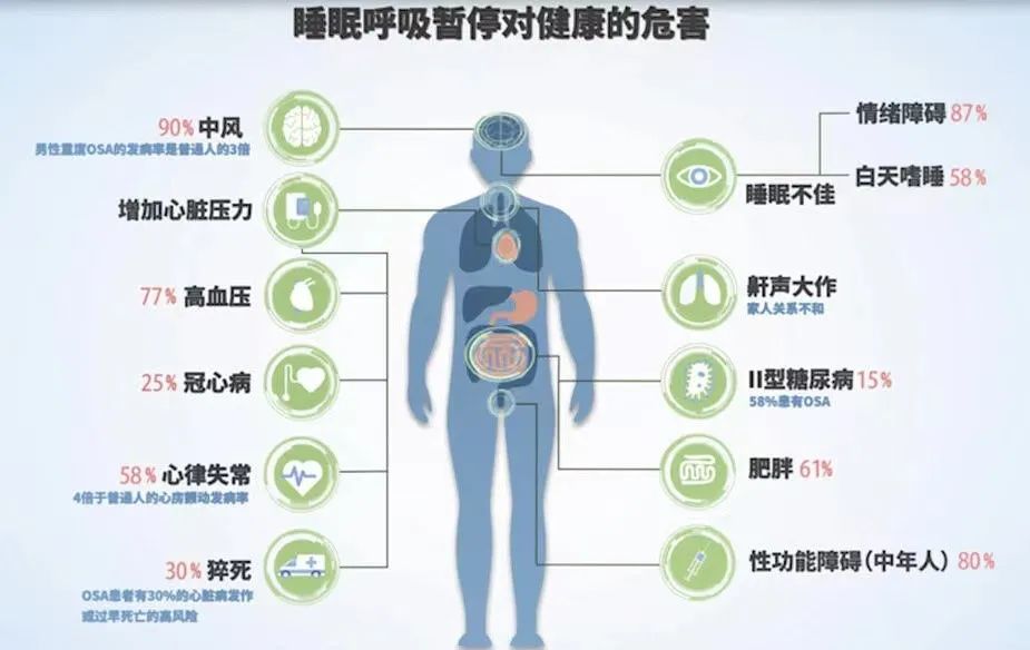 打呼噜怎么治疗？深度解析睡眠呼吸暂停及鼾症治疗方法