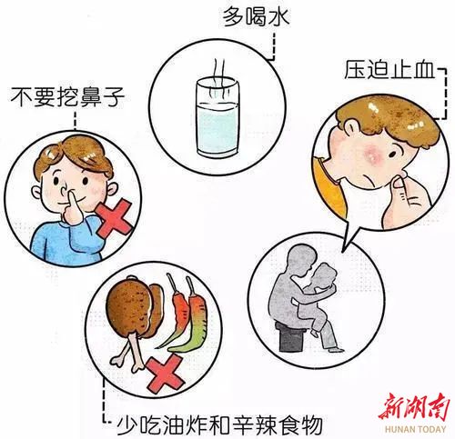 鼻子总出血怎么回事？探究鼻出血的常见原因、应对方法及预防措施