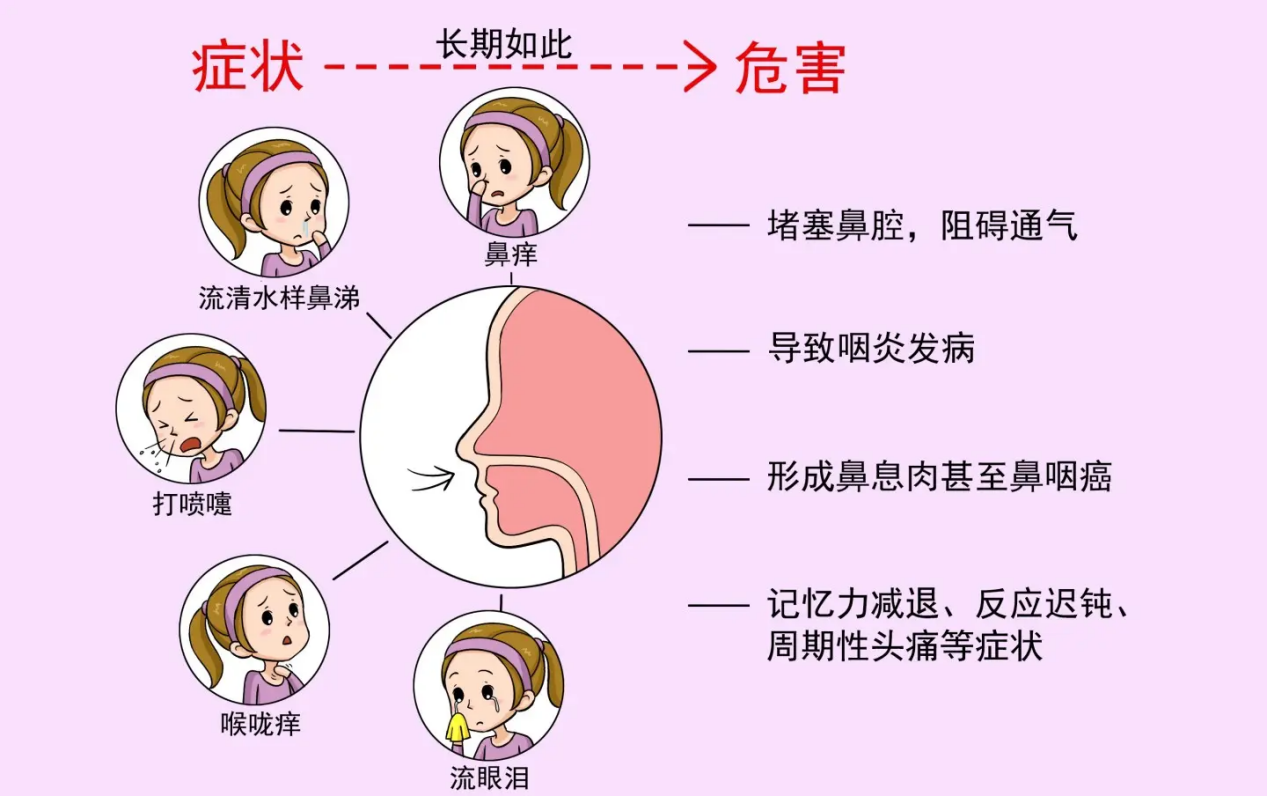 咽炎怎么治疗？深度解析咽炎治疗方法及注意事项