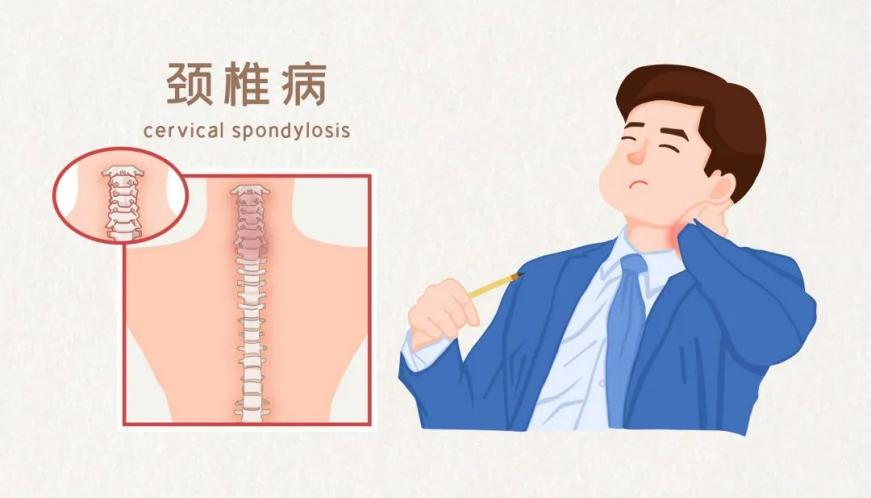 颈椎不好引起的头晕头昏？有效治疗方法及日常护理