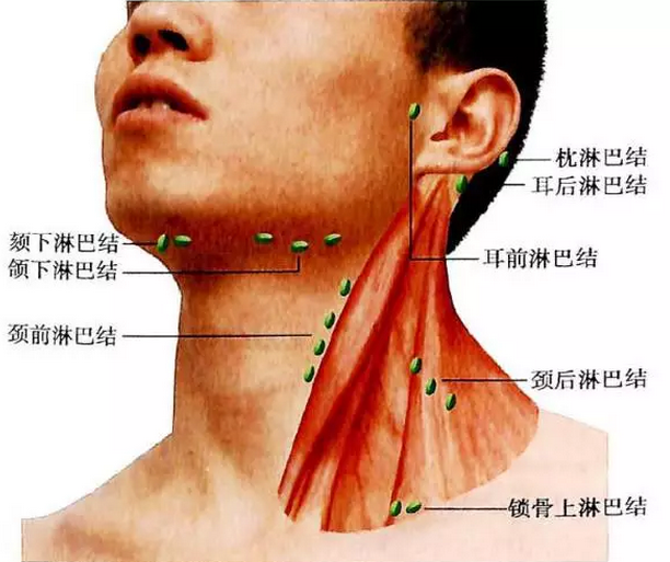 淋巴结肿大怎么消除？深度解析淋巴结肿大成因及有效应对方法