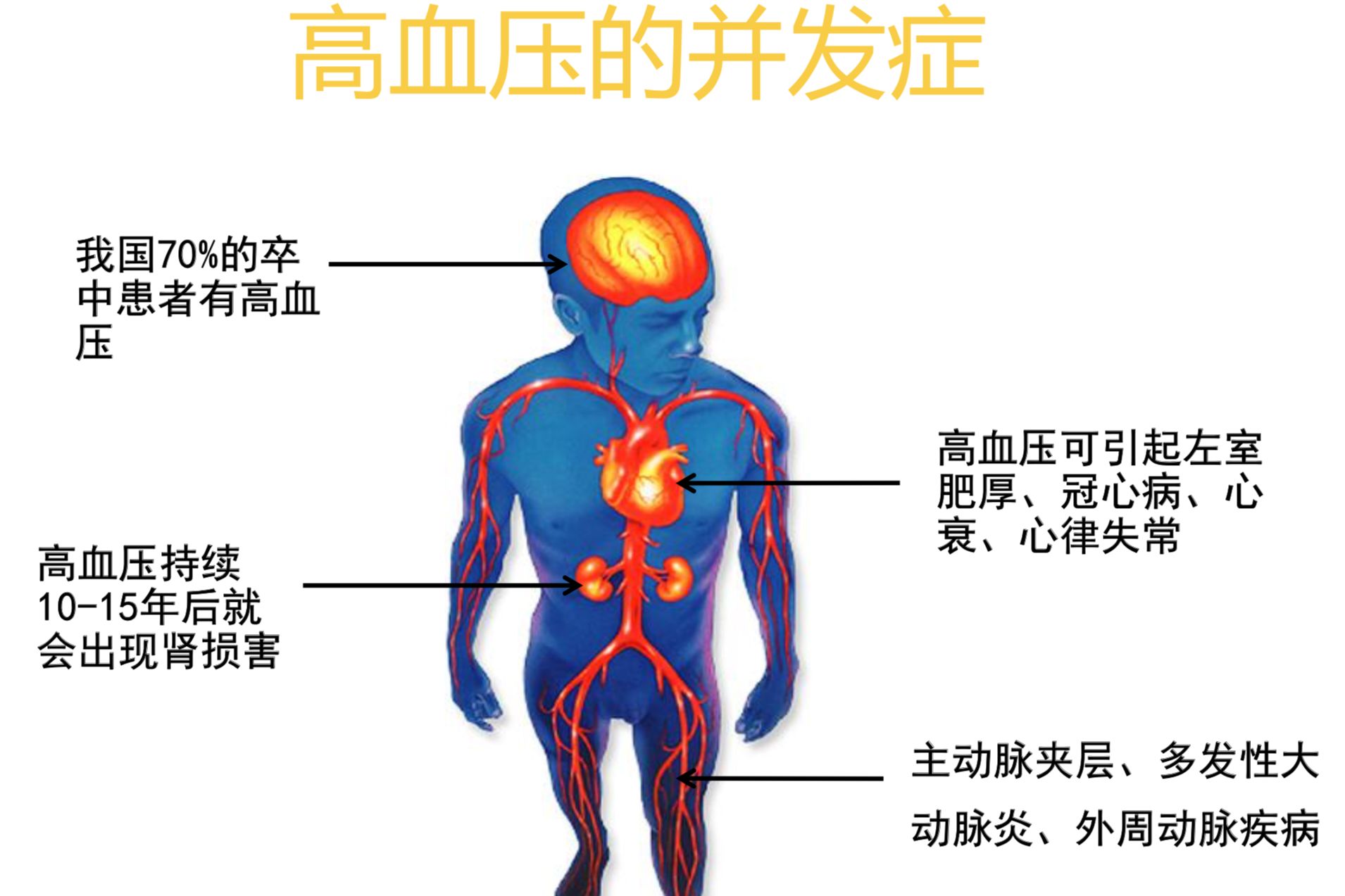 心梗是怎么引起的？深度解析心肌梗死发病机制及危险因素