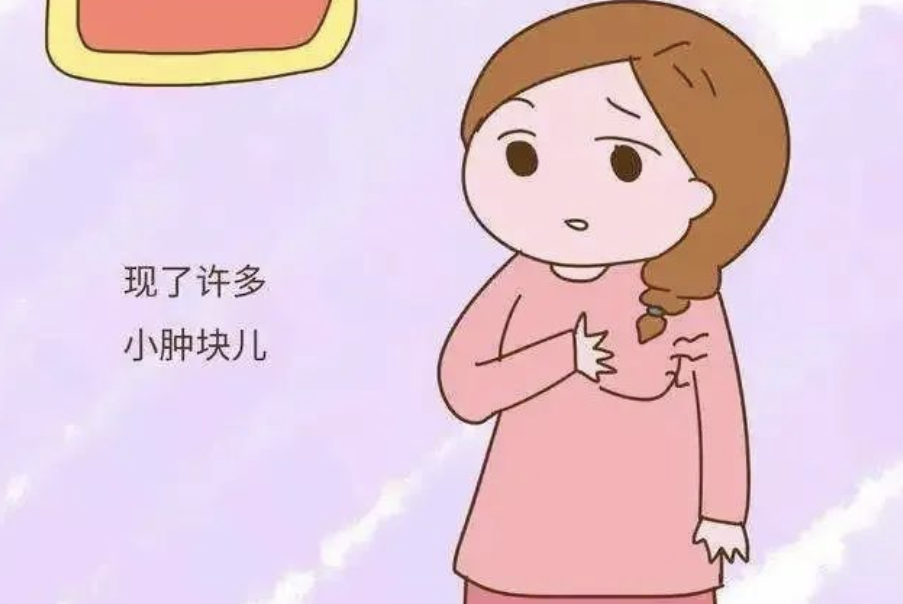 乳腺结节怎么治疗最好的方法？权威指南助您理性应对