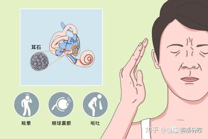 美尼尔综合症眩晕症怎么治疗？权威指南及最新疗法详解