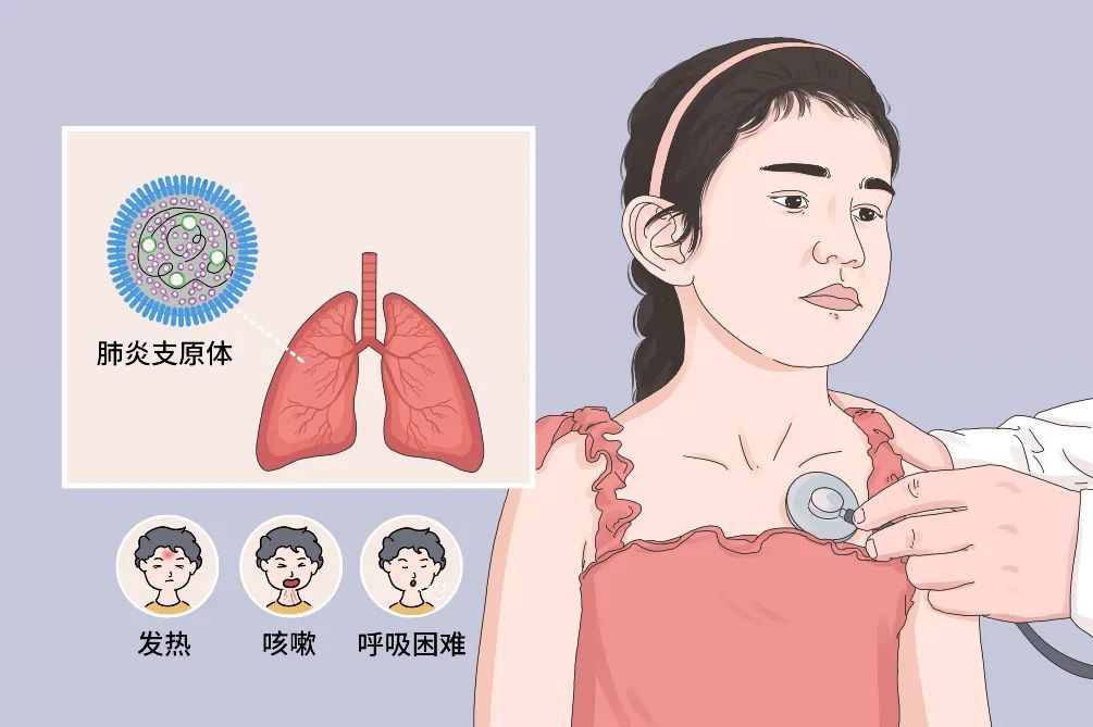 支原体衣原体感染是怎么回事？详解症状、诊断与治疗