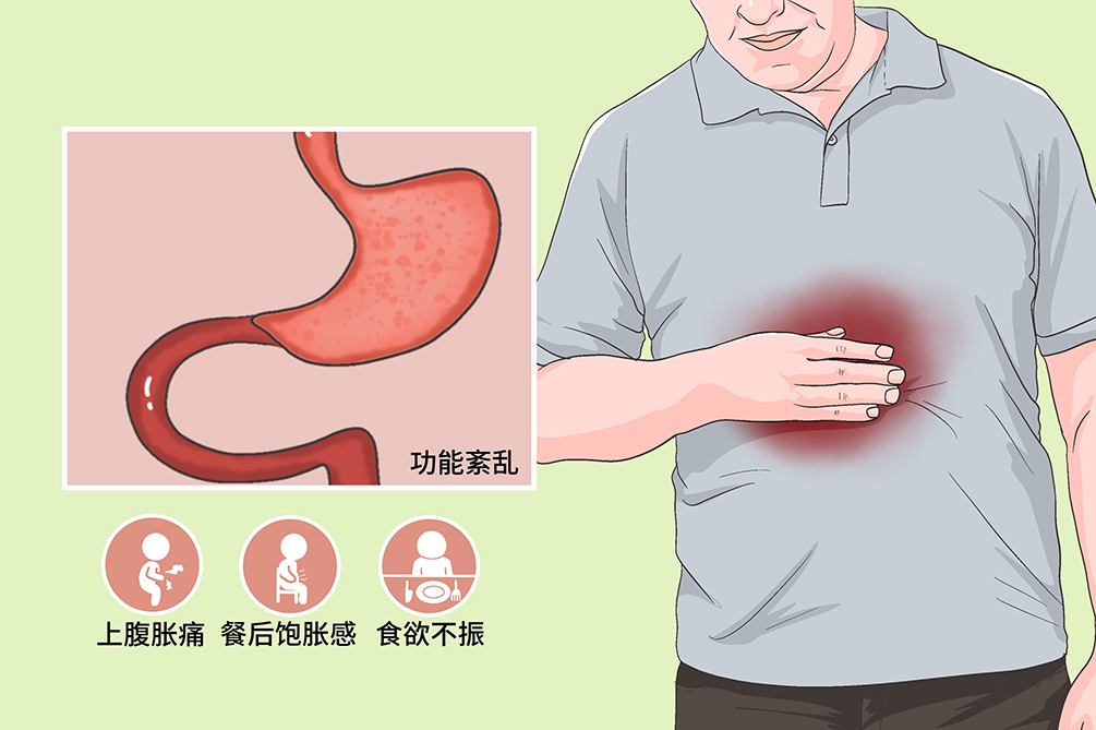 老是放屁是怎么回事？深度解析肠胃胀气及其他原因