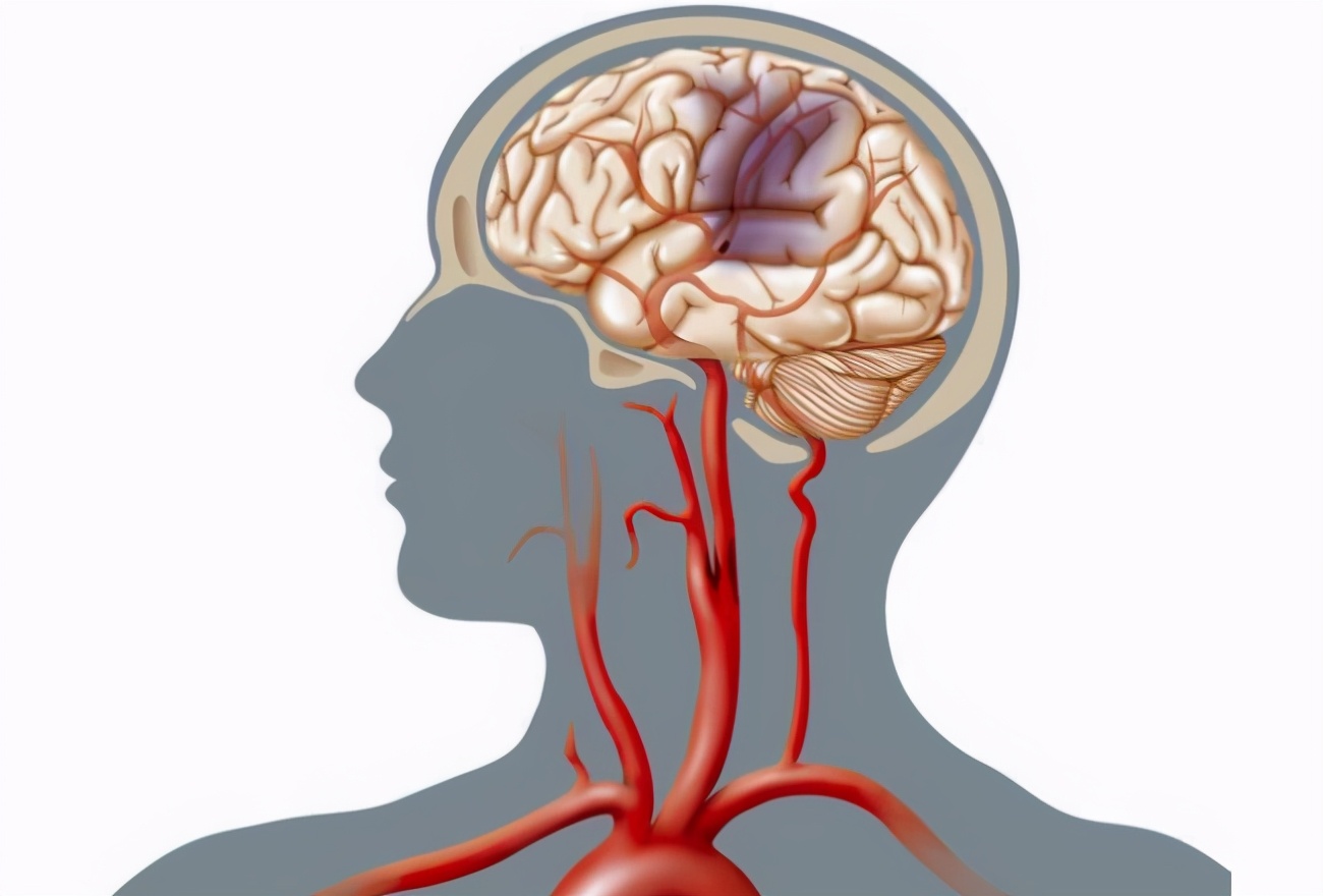 脑供血不足怎么调理好得快？权威指南助您快速恢复