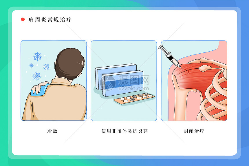 肩周炎怎么治疗？有效方法、康复步骤及潜在风险深度解析