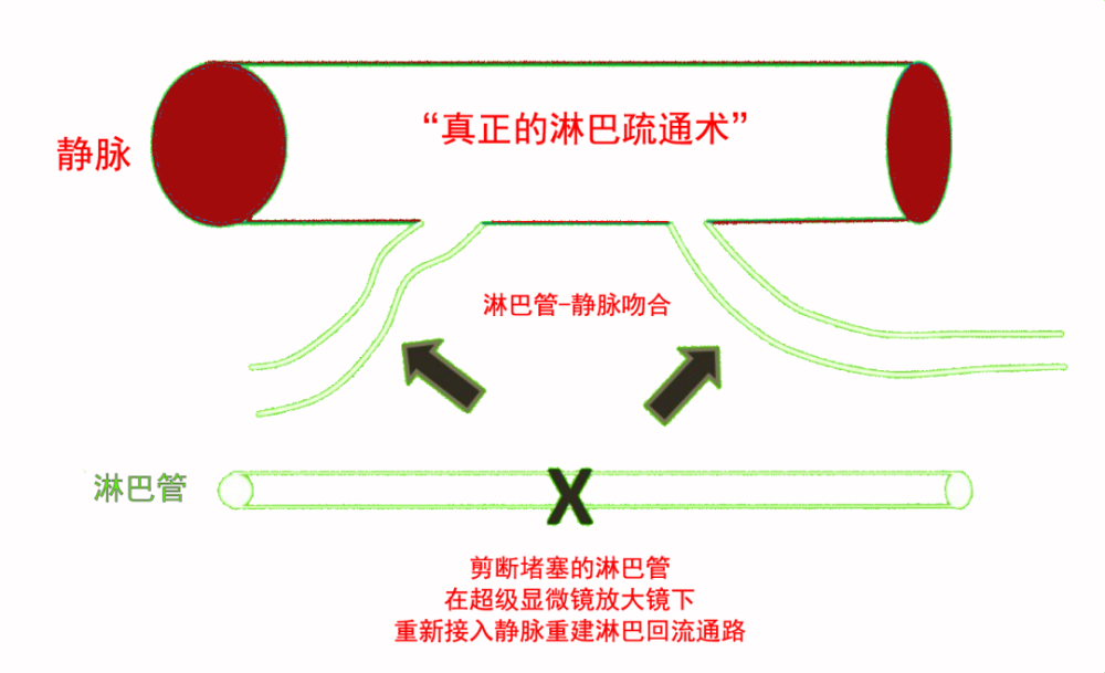 胎记是怎么形成的？探秘胎记成因、类型及潜在风险