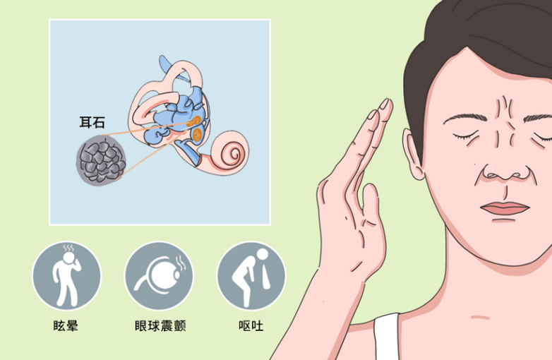 眩晕症怎么治？深度解析眩晕症的病因、诊断与治疗方法