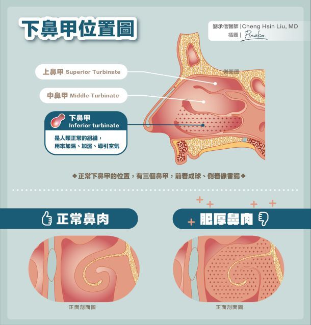 鼻塞的原因：从几个角度解析鼻塞的科学原理和治疗方法