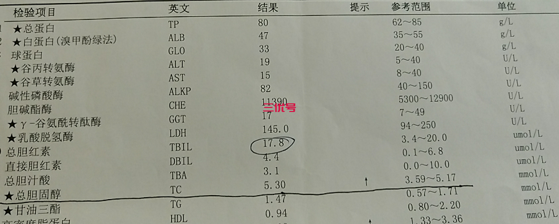 谷丙转氨酶高是怎么回事？肝脏健康不容忽视！