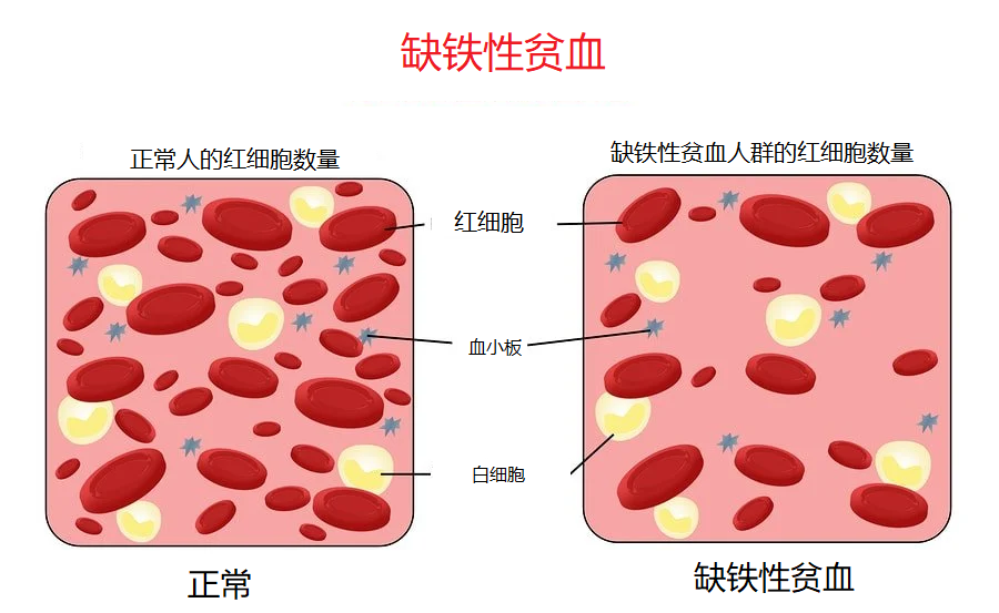 掉头发是怎么回事？深度解析脱发原因及应对策略