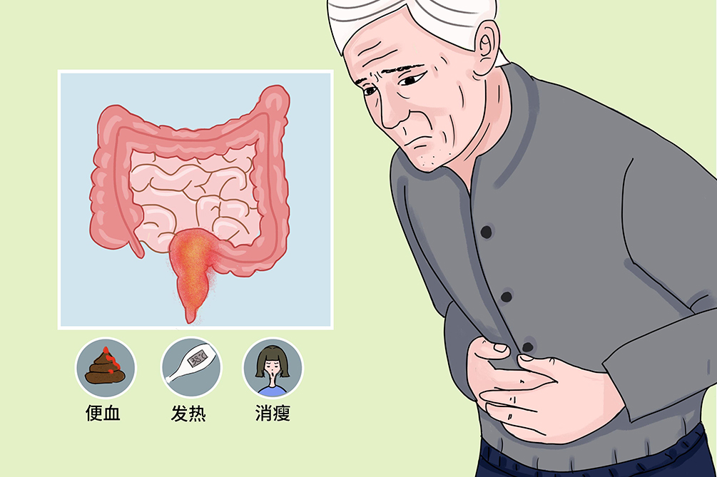 肠胃炎怎么办？实用指南助您快速缓解不适