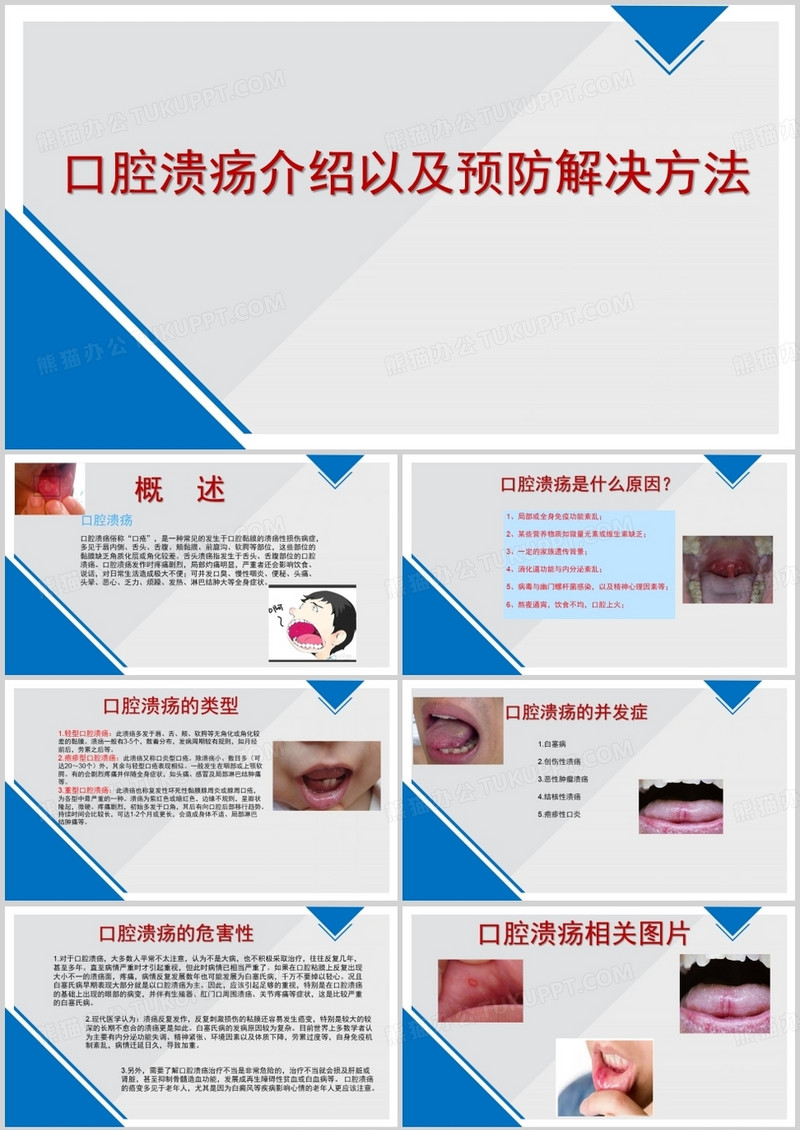 口腔溃疡怎么治？深度解析口腔溃疡的治疗方法及预防措施