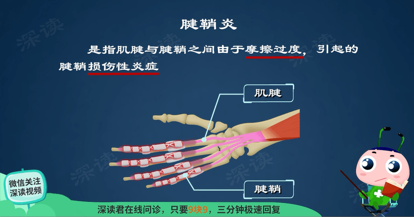 腱鞘炎是怎么引起的？深度解析致病因素及预防方法