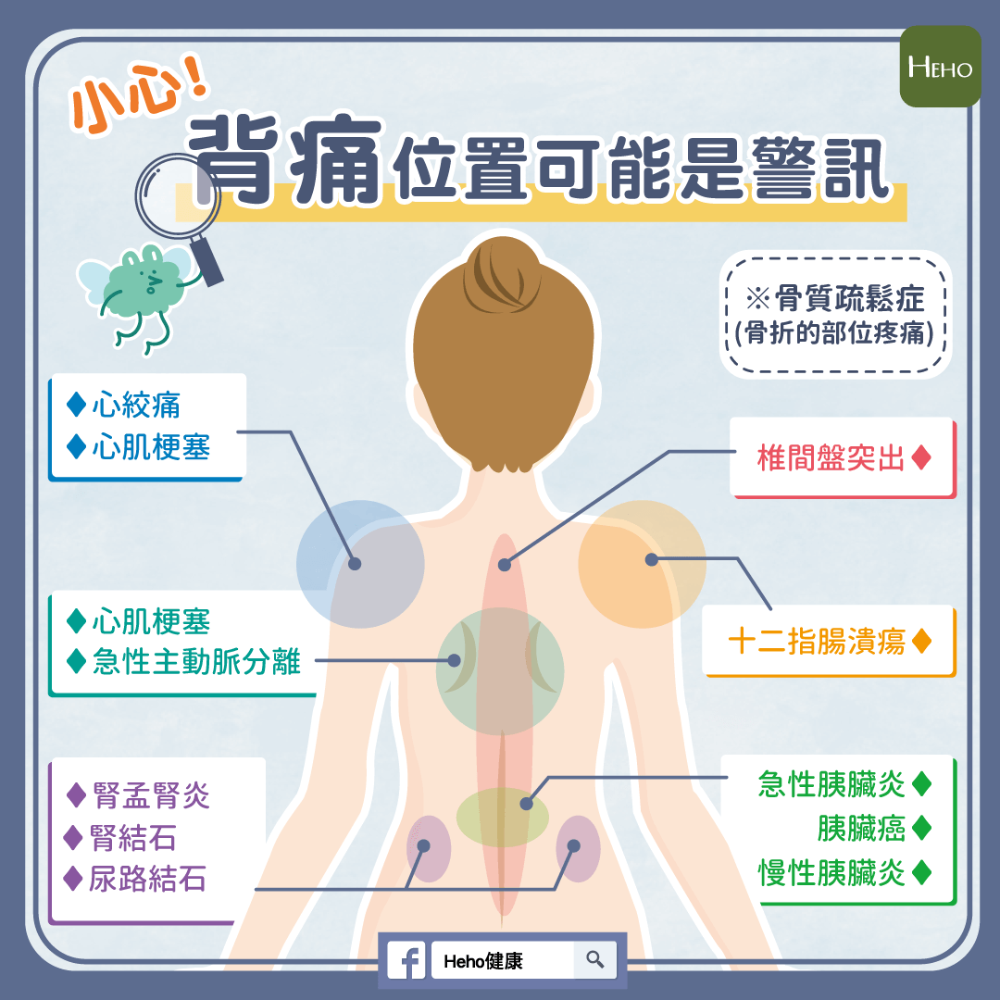 背疼是什么事？各类背疼的原因和治疗方法