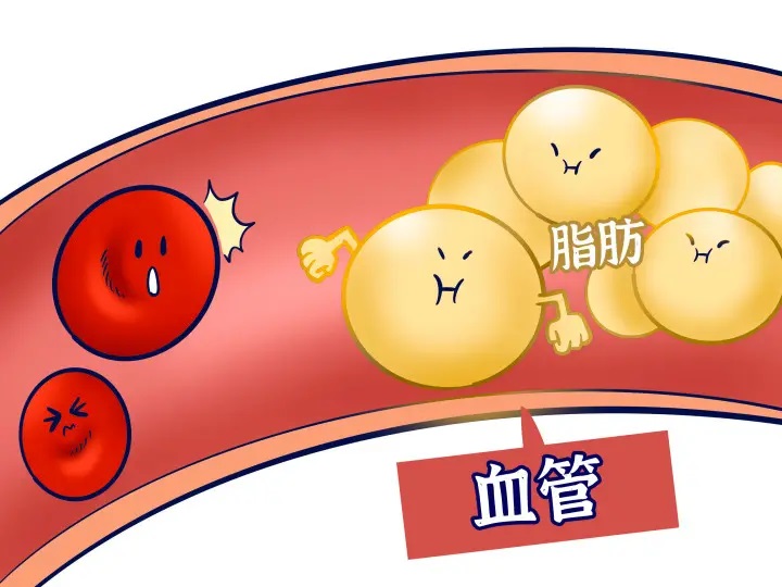 蛋白偏高怎么办？详解高蛋白血症的成因、危害及应对策略