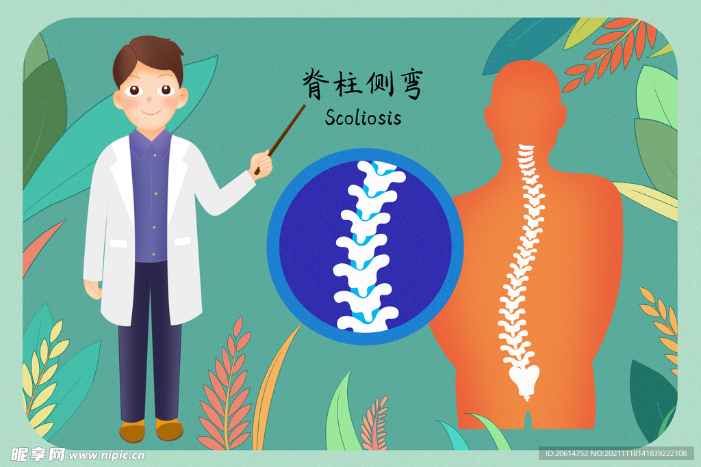 脊柱侧弯是怎么回事？深度解析病因、症状及治疗方法