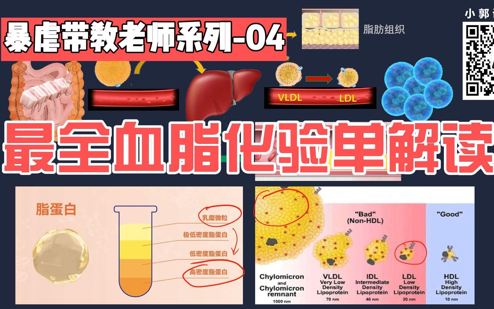 血脂怎么检查？全面解读血脂检查流程、指标及意义