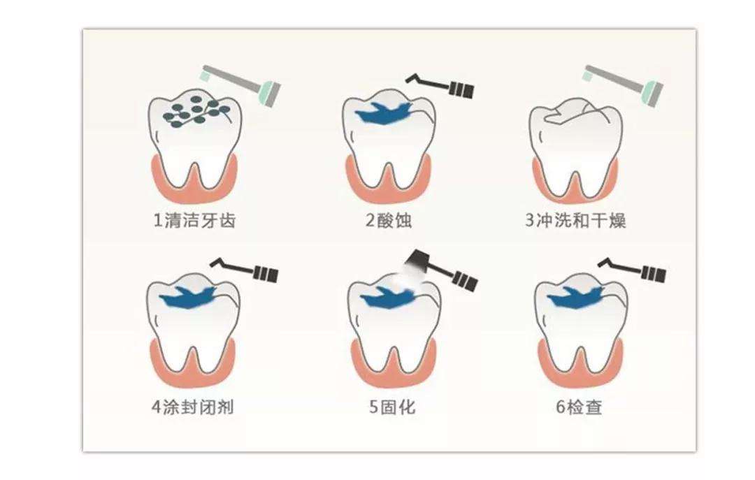 牙齿内壁掉了一块舔着难受怎么办？深度解析及应对策略