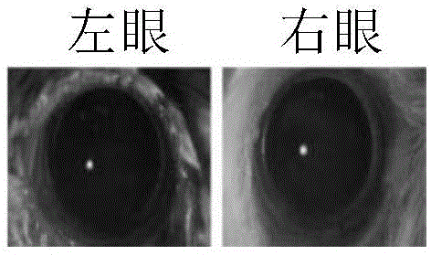 眼睛干怎么办？深度解析干眼症的成因、症状及有效缓解方法