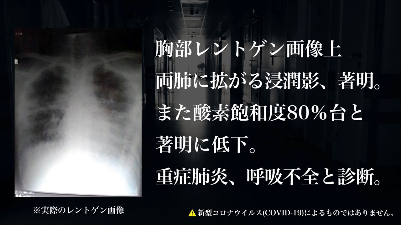 怎么治疗前再肺炎：从原因到治疗策略的全面分析