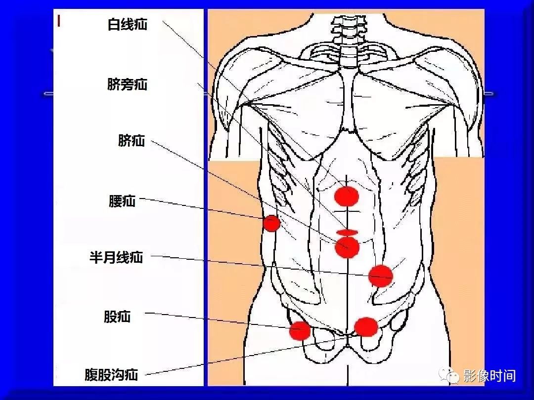 化茧成蝶 第52页