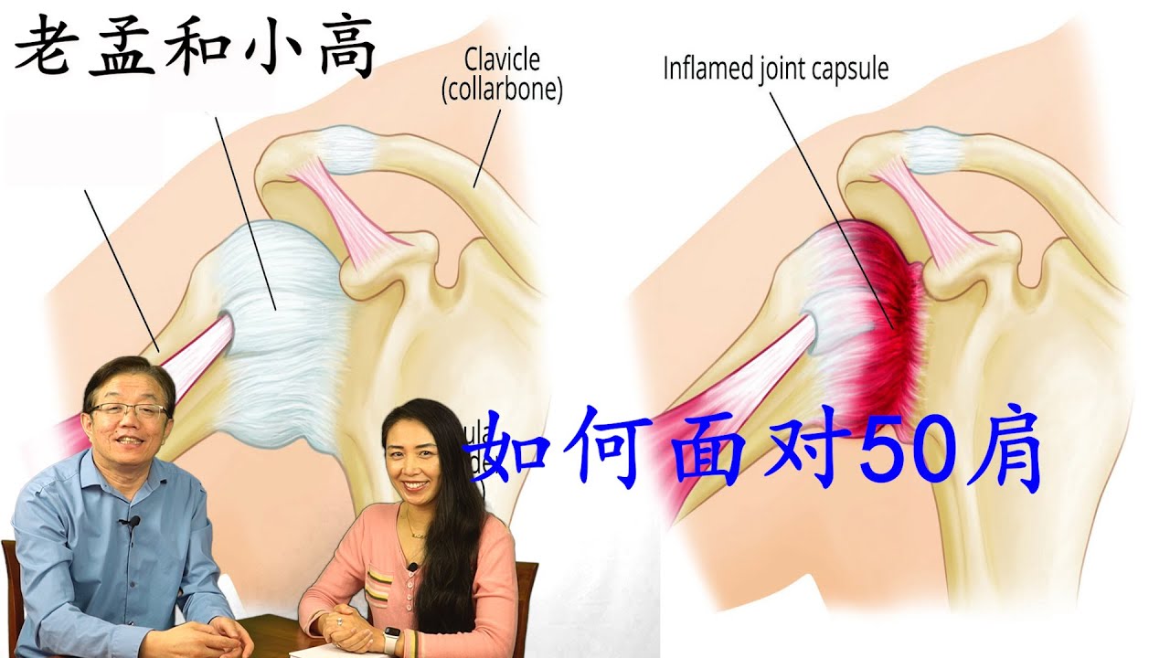 没肩子怎么办？全面分析和解决方案