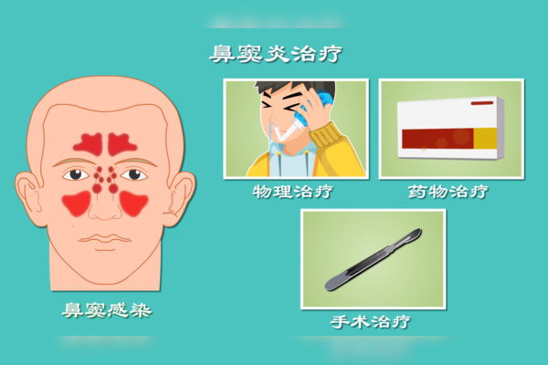 鼻涕是黄色的怎么回事？深入探讨鼻涕颜色变化及健康隐患