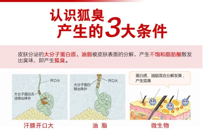 腋下出汗多有异味怎么办？多维度深度解析及解决方法