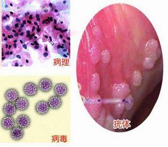 外阴瘙痒怎么回事？女性私处瘙痒的常见原因、诊断及治疗方法