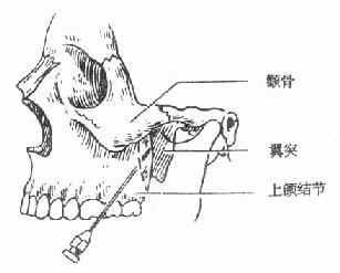 快速解答 第606页