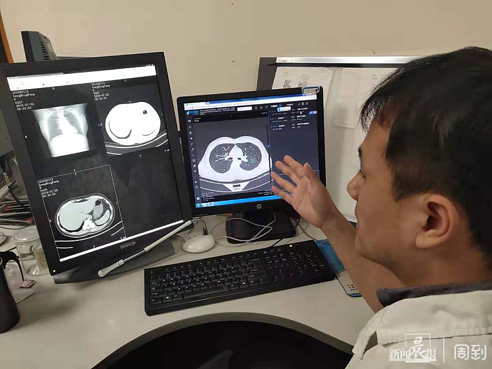 双肺纹理增多是怎么回事？深度解析肺部影像学及相关疾病