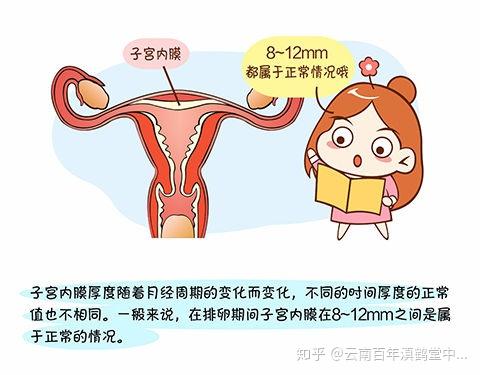 50岁子宫内膜增厚怎么办？详解诊疗及生活调理