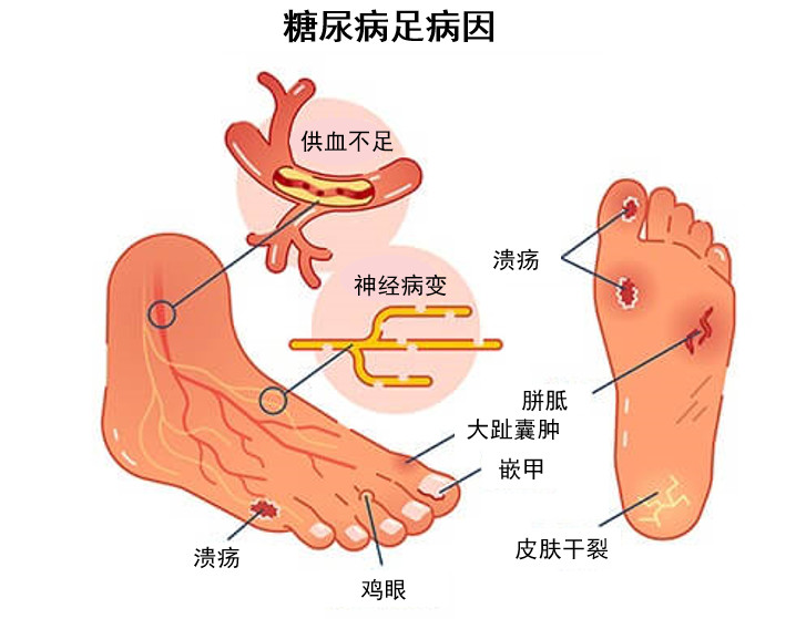 伤口不愈合怎么办？深度解析伤口愈合难题及应对策略