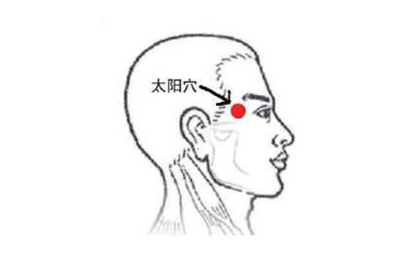 太阳穴疼是怎么回事？深度解析常见原因及应对方法