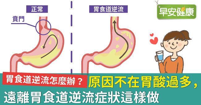 胃上起反酸水怎么办？从原因到治疗的全面解析