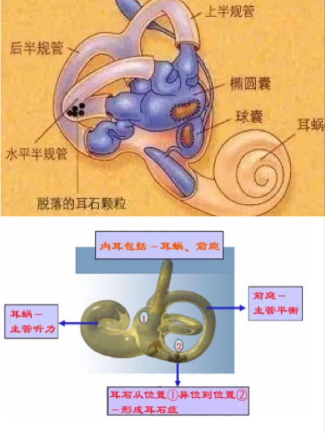 耳石症诊断指南：何么判断是不是耳石症？从症状到检查方法的完整解释