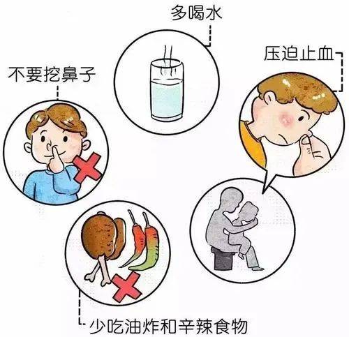 鼻子出血怎么止血？家庭急救指南及专业处理方法