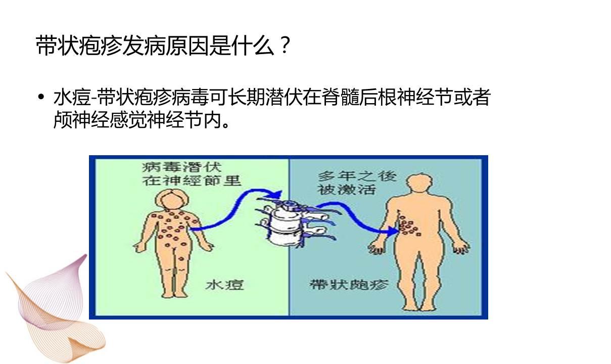 疱疹后遗症怎么治疗？深度解析及全面治疗方案