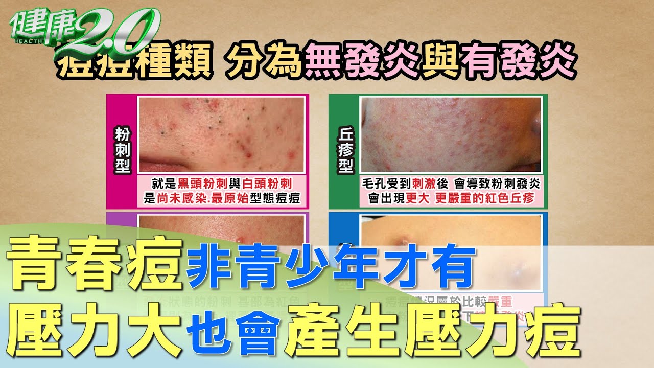 怎么消除痤疮？从根源入手，有效改善痘痘肌