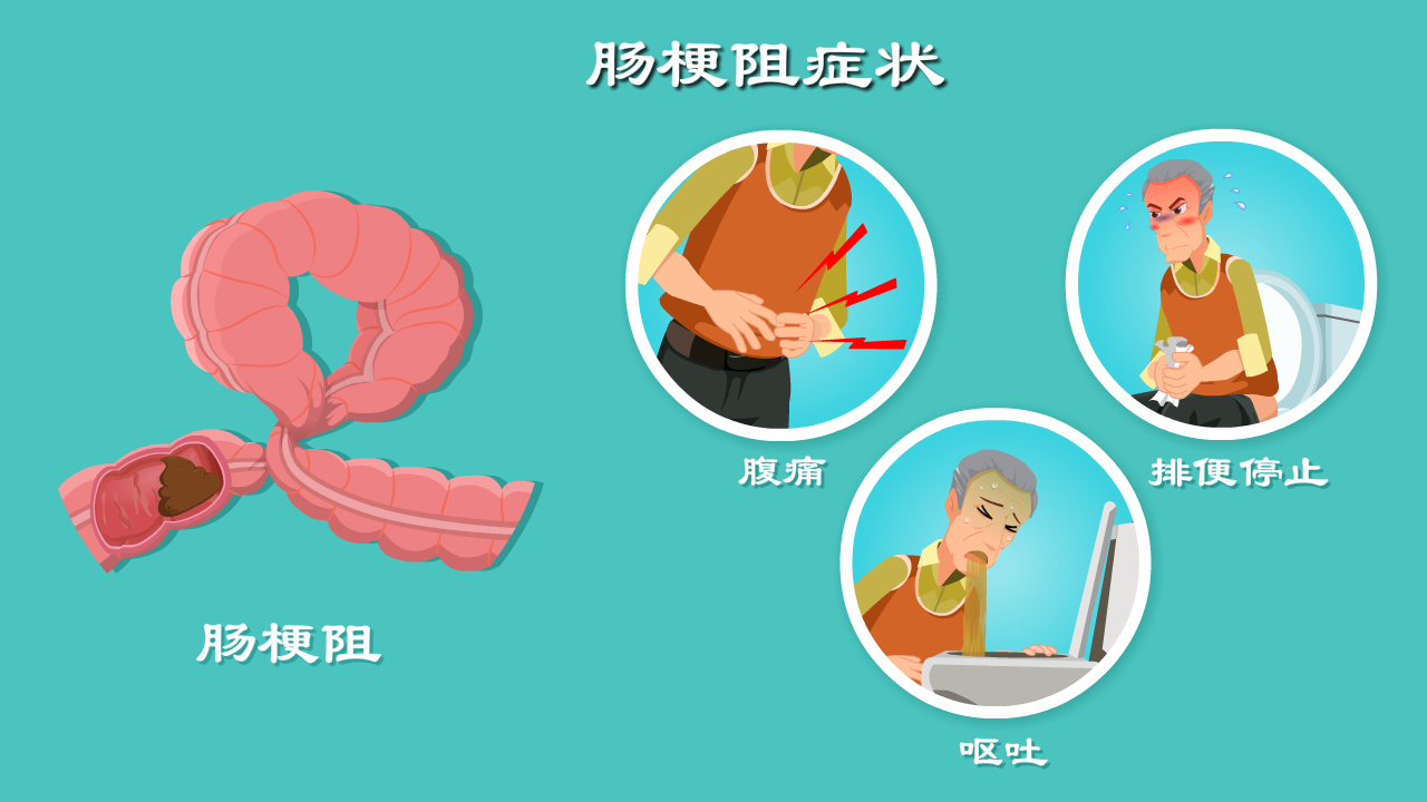 大便像水一样喷出来怎么回事？深度解析肠道疾病与紧急处理