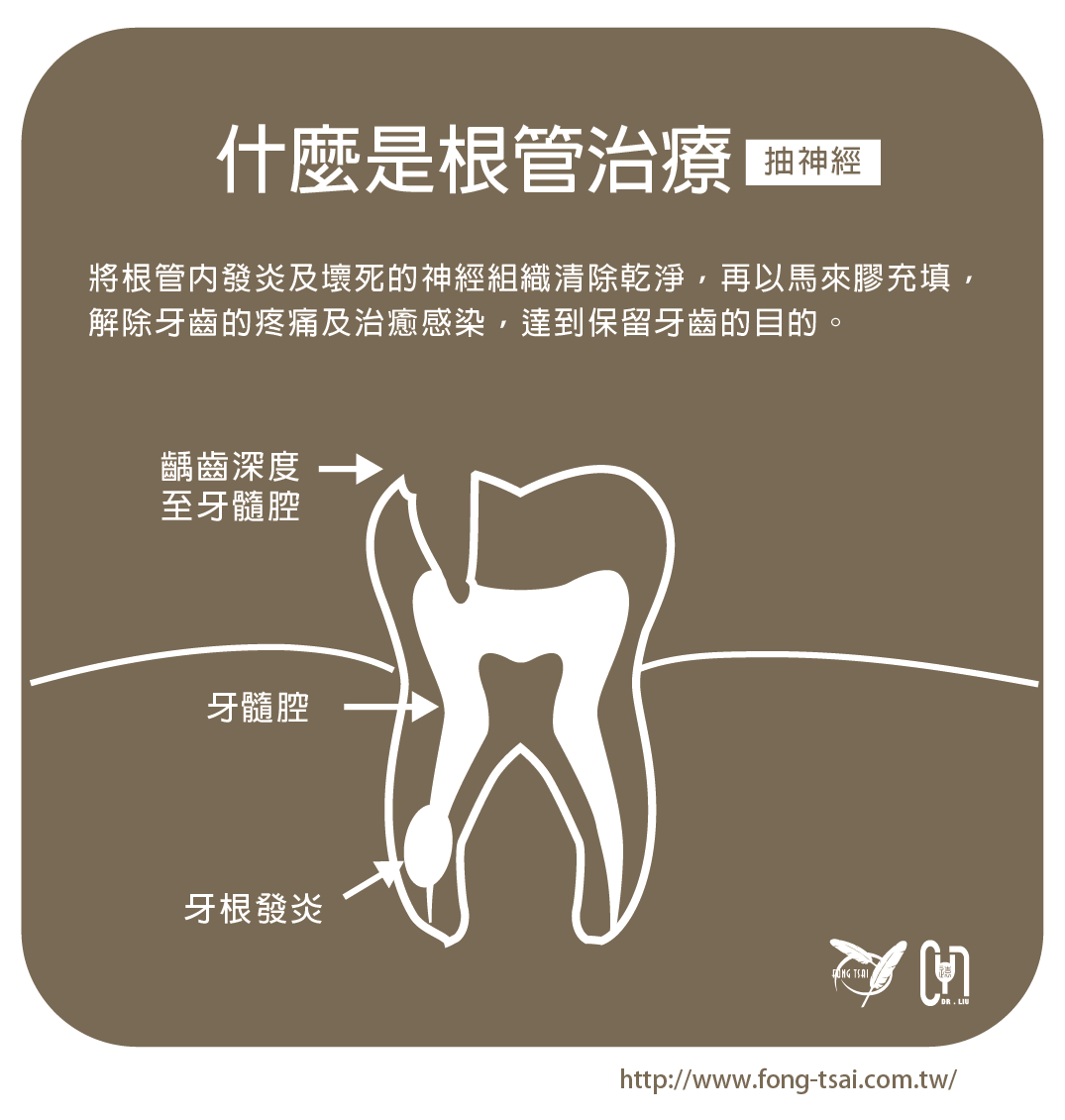 智齿蛀牙烂空了怎么办？详解治疗方案及预防措施